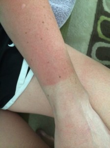 Ouch.  Ugh.  I know.